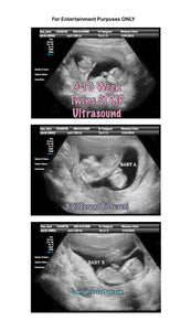 Fake Ultrasound 9-10 Week Twins