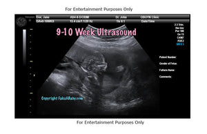 9-10 Week Ultrasound Fake Sonogram