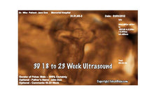 3D 18 to 23 Weeks Ultrasound