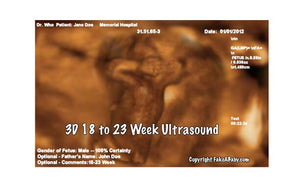 3D 18 to 23 Weeks Ultrasound
