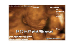 3D 20 to 28 Weeks Ultrasound
