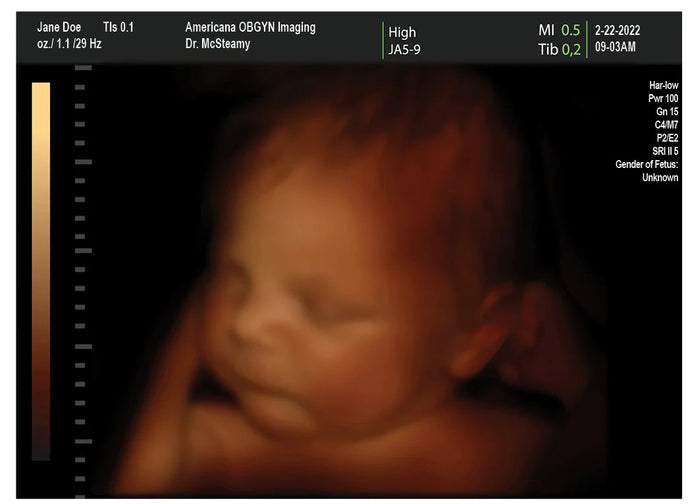 Unmasking Deception: Navigating the Maze of Fake 4D Pregnancy Ultrasounds