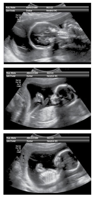The Miracle of Modern Technology: Introducing Fakeababy UltraScan