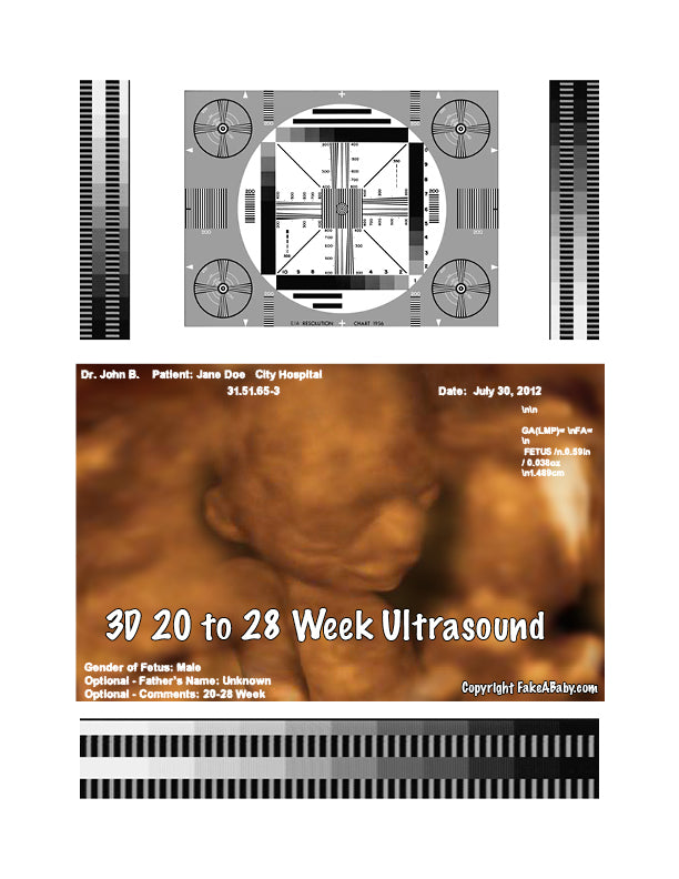 Einfache Anleitung zur Erbringung eines 2D-gefälschten Ultraschalls
