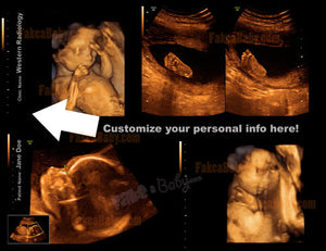 Customize 3D Ultrasound pictures