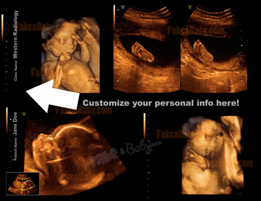 Our Premium Fake Ultrasound Collection