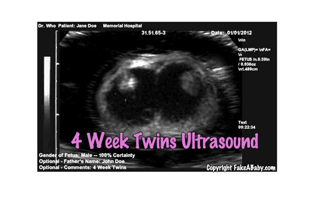O fator divertido com um ultrassonografia de gêmeos falsos