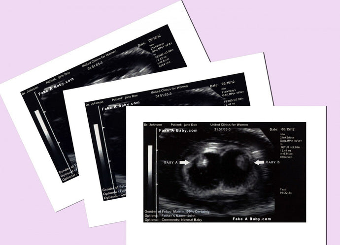 Fake Ultrasound - Strip of 4 — 2D Customized