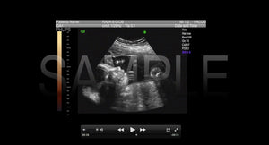 BRAND NEW FAKE SONOGRAM DVD VIDEOS! ON SALE FOR A LIMITED TIME!!!