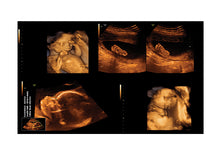 Custom 4D Prank Fake Ultrasound Design!