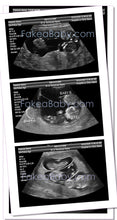 Prank Fake Ultrasound Sonogram 10-14 Week Triplets