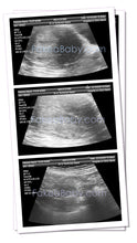 Prank Fake Sonogram Ultrasound! 3 Different Photos! Free Shipping!