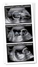 Prank Fake Sonogram Ultrasound! 3 Different Photos! Free Shipping!