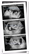 Customer Fake Ultrasound Sonogram — Prank your friends now!