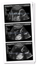 Customer Fake Ultrasound Sonogram — Prank your friends now!