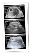 Prank Fake Ultrasound 3-4 Weeks