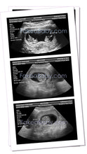 Prank Fake Ultrasound 4-6 Week Twins