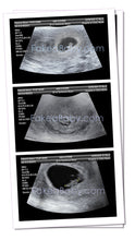 Prank Fake Ultrasound 4-6 Weeks