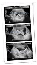 Prank Fake Ultrasound 7-8 Week Twins