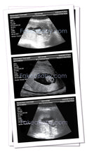 Prank Fake Sonogram Ultrasound! 3 Different Photos! Free Shipping!