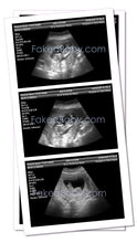 Prank Fake Sonogram Ultrasound! 3 Different Photos! Free Shipping!
