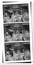 Prank Fake Sonogram Ultrasound! 3 Different Photos! Free Shipping!