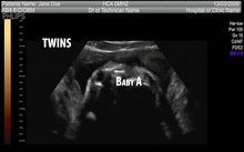 FAKE SONOGRAM VIDEOS! ON SALE FOR A LIMITED TIME!!! FREE EMAIL DELIVERY TODAY!