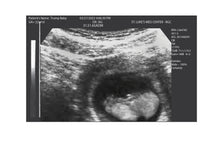 April Dummköpfe Besonderer gefälschter Ultraschall! 2d gefälschter Ultraschall. Erhalten Sie 3 Fotos!