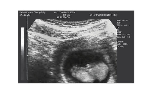 New Funny Trump Baby Ultrasound! Fake Ultrasound! 2D Fake Ultrasound. Get 3 Photos!