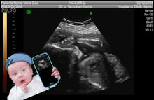 FAKE SONOGRAM VIDEOS! ON SALE FOR A LIMITED TIME!!! FREE EMAIL DELIVERY TODAY!