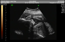 FAKE SONOGRAM VIDEOS! ON SALE FOR A LIMITED TIME!!! FREE EMAIL DELIVERY TODAY!