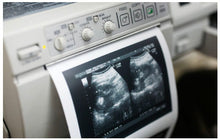 Please Print My Documents on REAL Clinical Thermal Ultrasound Paper