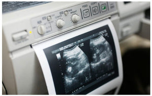 Please Print My Documents on REAL Clinical Thermal Ultrasound Paper