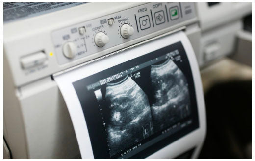 Please Print My Documents on REAL Clinical Thermal Ultrasound Paper