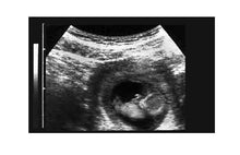 Prank Fake Ultrasound 11-12 Week Fetus INSTANT EXPRESS EMAIL ONLY DELIVERY!