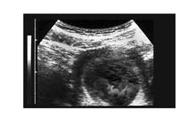 Prank Fake Ultrasound 7-8 Week Fetus INSTANT EXPRESS EMAIL ONLY DELIVERY!