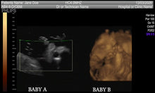 FAKE SONOGRAM VIDEOS! ON SALE FOR A LIMITED TIME!!! FREE EMAIL DELIVERY TODAY!