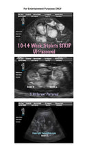 10-14 week twins with arrows strip ultrasound in 3 different pictures