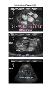 10-14 week twins with arrows strip ultrasound in 3 different pictures