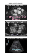Fake Ultrasound 10-14 Week Triplets