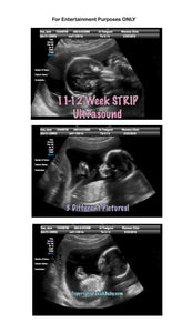 Fake Ultrasound 11-12 Week