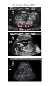 Fake Ultrasound 13-14 Week Twins
