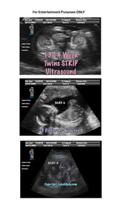 13-14 week twins with arrows strip ultrasound in 3 different pictures