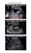 14-15 weeks strip ultrasound in 3 different pictures