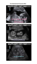 Fake Ultrasound 14-15 Weeks