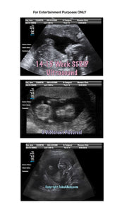 Fake Ultrasound 14-15 Weeks