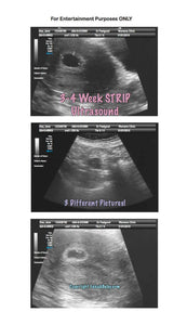 3-4 weeks strip ultrasound in 3 different pictures