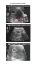 Fake Ultrasound 3-4 Weeks