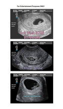 4 to 6 weeks strip ultrasound in 3 different pictures