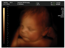 Brand New! 4D Fake Ultrasound Generator Free! Create Fake Ultrasounds and Fake Sonograms for Free!